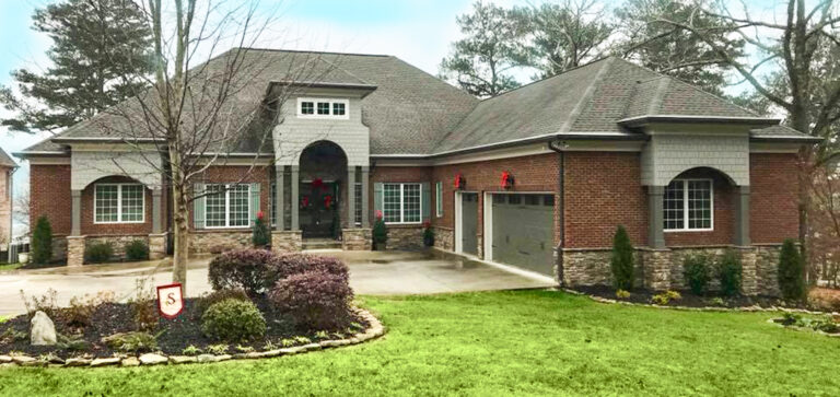 Facelift with Stone – After